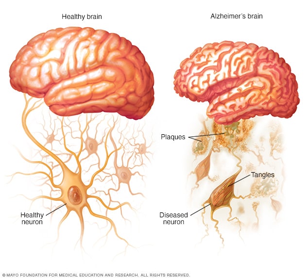 A Comprehensive Review of Developments in Neuroimaging Technology